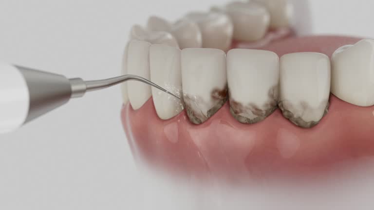 Reliable Tooth Extraction contractor in Washington County County, ME by Dentist Open Now
